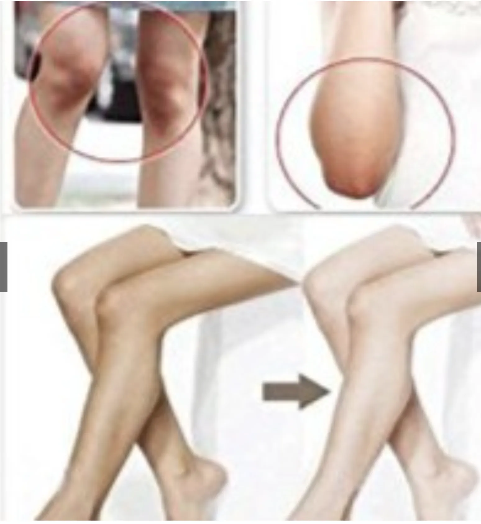 Отбеливающий крем - подмышки, внутренняя поверхность бедра, локоть, колено#4
