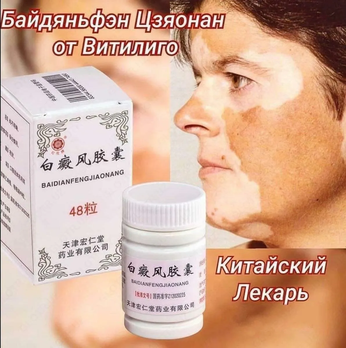 Baidianfeng Jiaonan kapsulalari vitiligoga qarshi#2