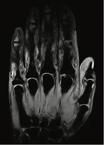 МРТ для исследования костно-мышечной системы Esaote S-Scan#3