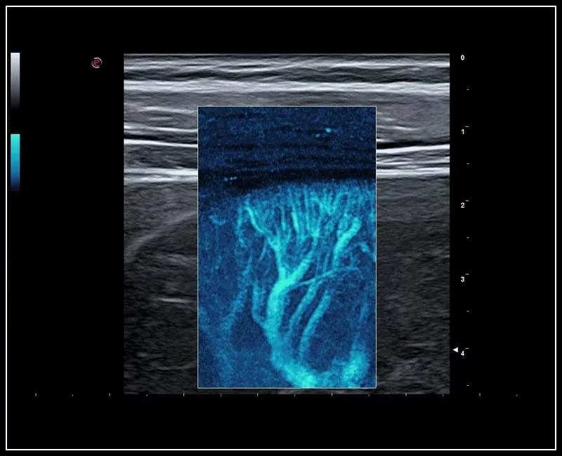 Многофункциональный ультразвуковой томограф Esaote MyLab 9 eXp#9