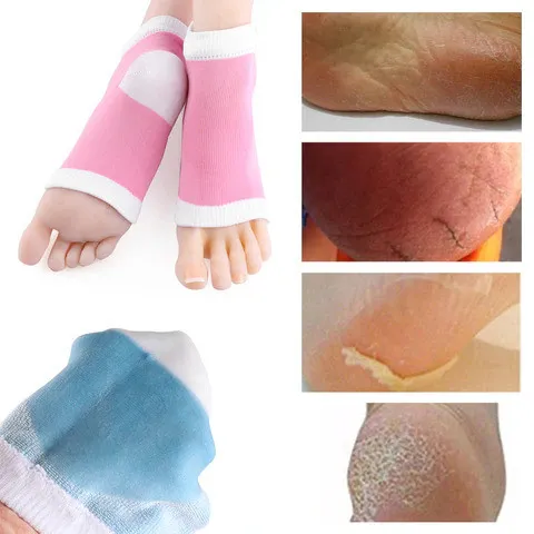 Увлажняющие силиконовые носки#3