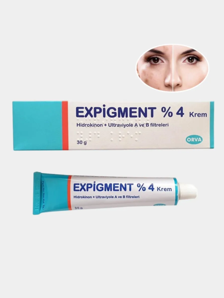Осветляющий крем при нарушении пигментации кожи Expigment 4% (30 грамм)#3