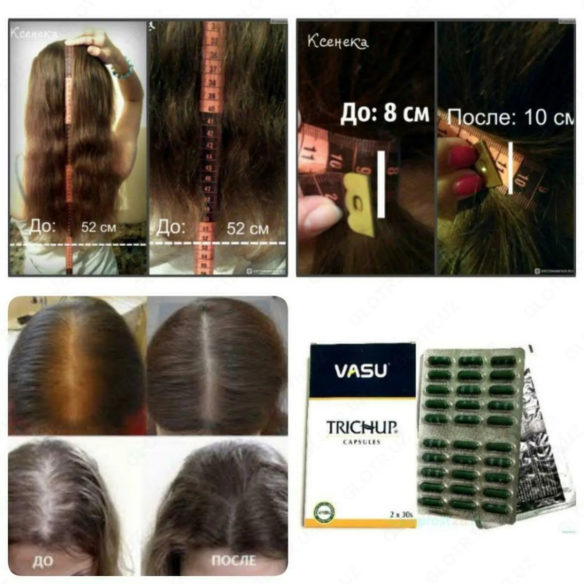 Травяные капсулы для роста волос Trichup Vasu (60шт)#4