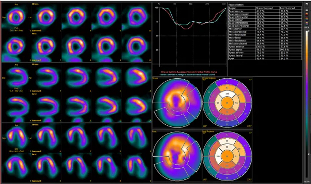 Mediso AnyScan SPECT-CT-PET tizimi#4