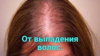 Миноксидил 10% лосьон для волос женский#4