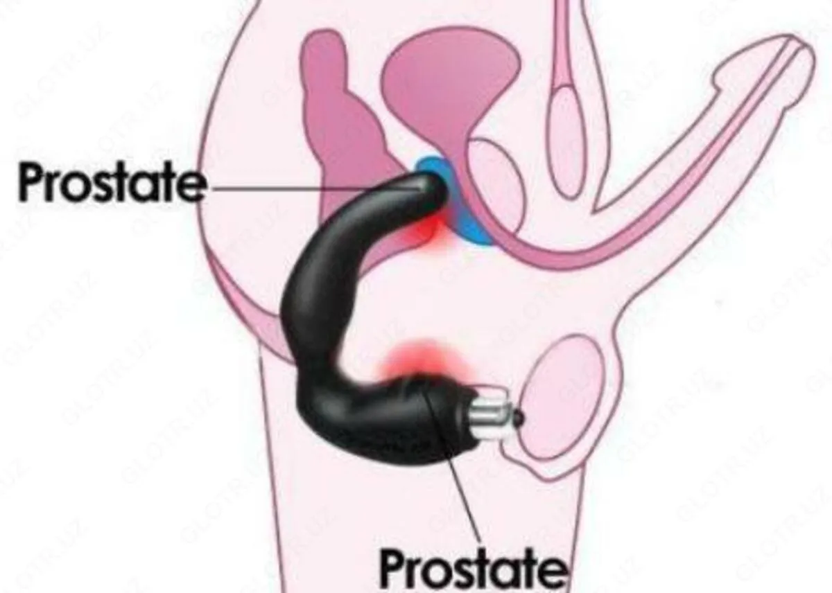 Urologik prostata massajchisi#3