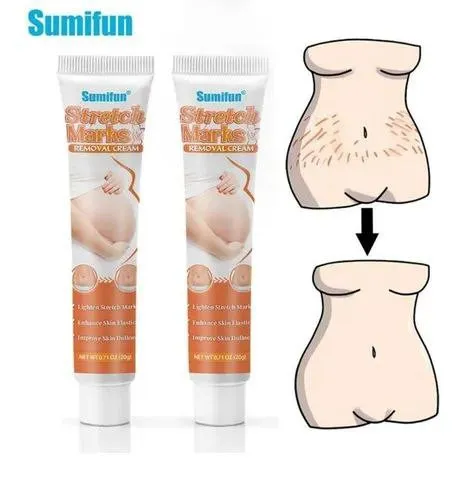 Крем от растяжек Sumifun Stretch Marks Cream 20 g#2
