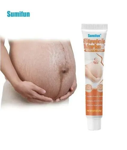 Крем от растяжек Sumifun Stretch Marks Cream 20 g#3