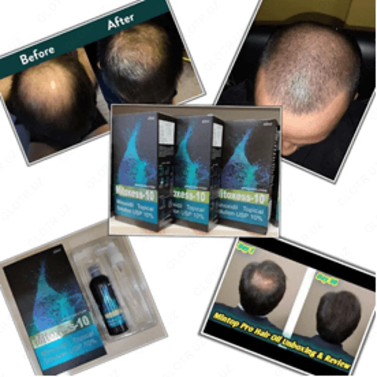 Mitoxess %10 - Препарат для роста волос и бороды#2