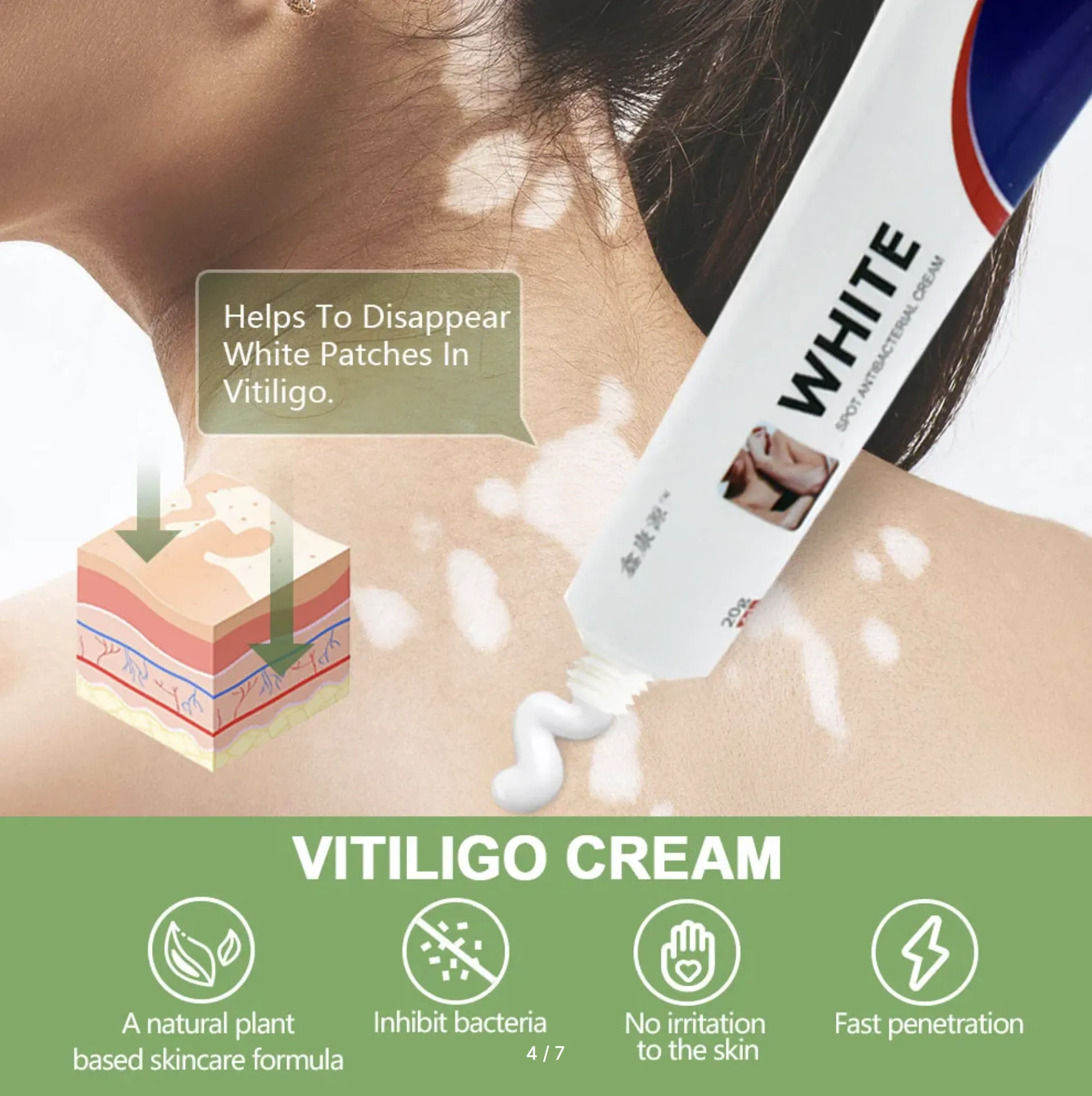 Oq-vitiligo davolash uchun krem, 20 g#4