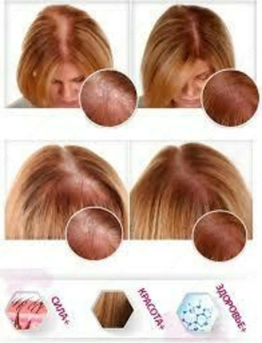 Травяные капсулы для роста волос Trichup Vasu (60шт)#5
