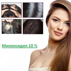 Женский шампунь для восстановления волос Миноксидил 10%#3
