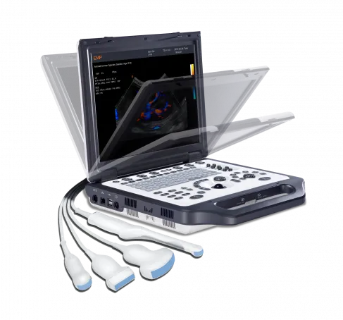 Переносной Ультразвуковой сканер Emperor Medical EMP G30#3