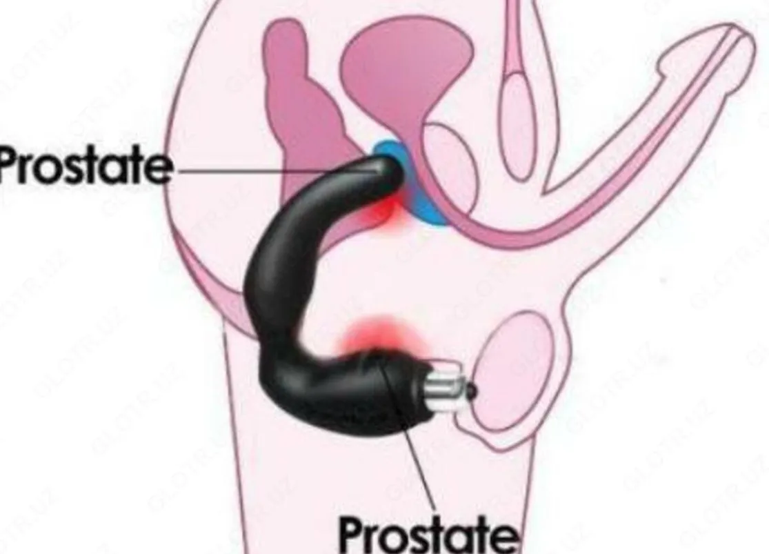 Prostata urologik massaji#2
