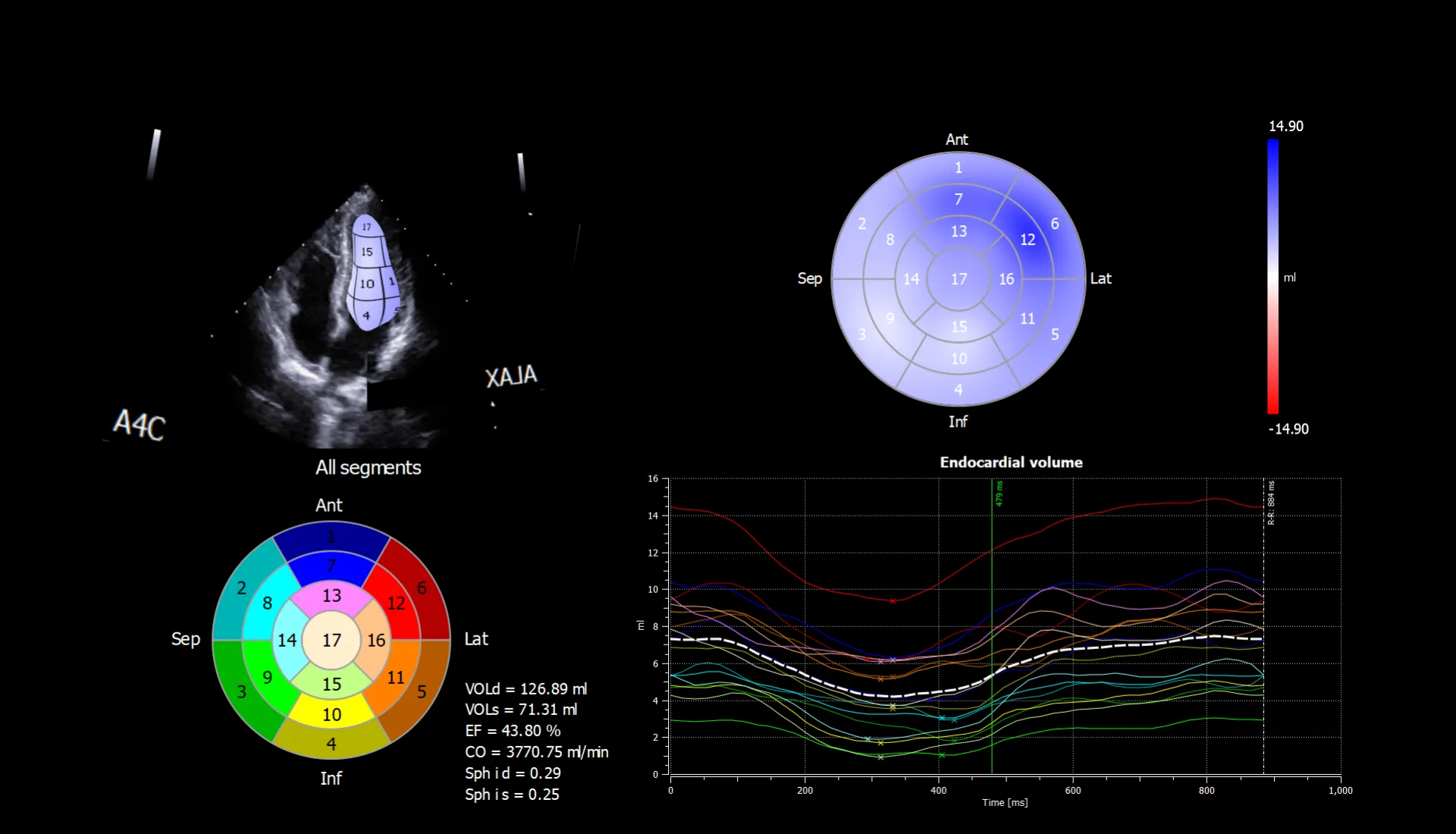 Универсальный ультразвуковой сканер Esaote MyLab X75#7