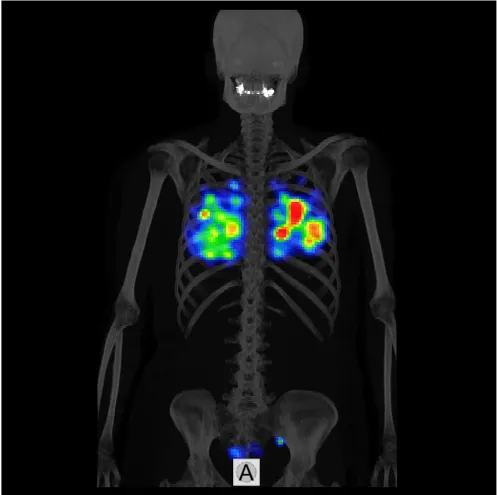 Mediso AnyScan SPECT-CT-PET tizimi#2