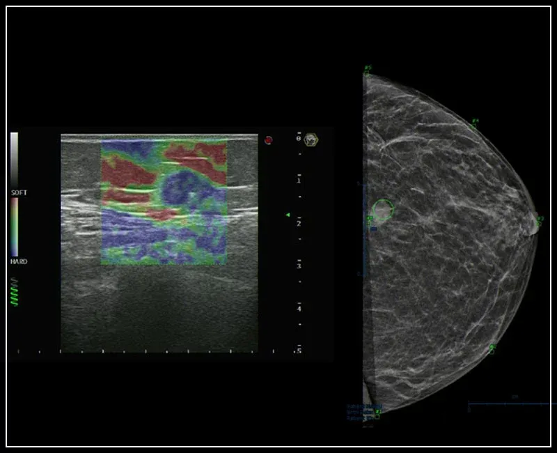 Многофункциональный ультразвуковой томограф Esaote MyLab 9 eXp#3