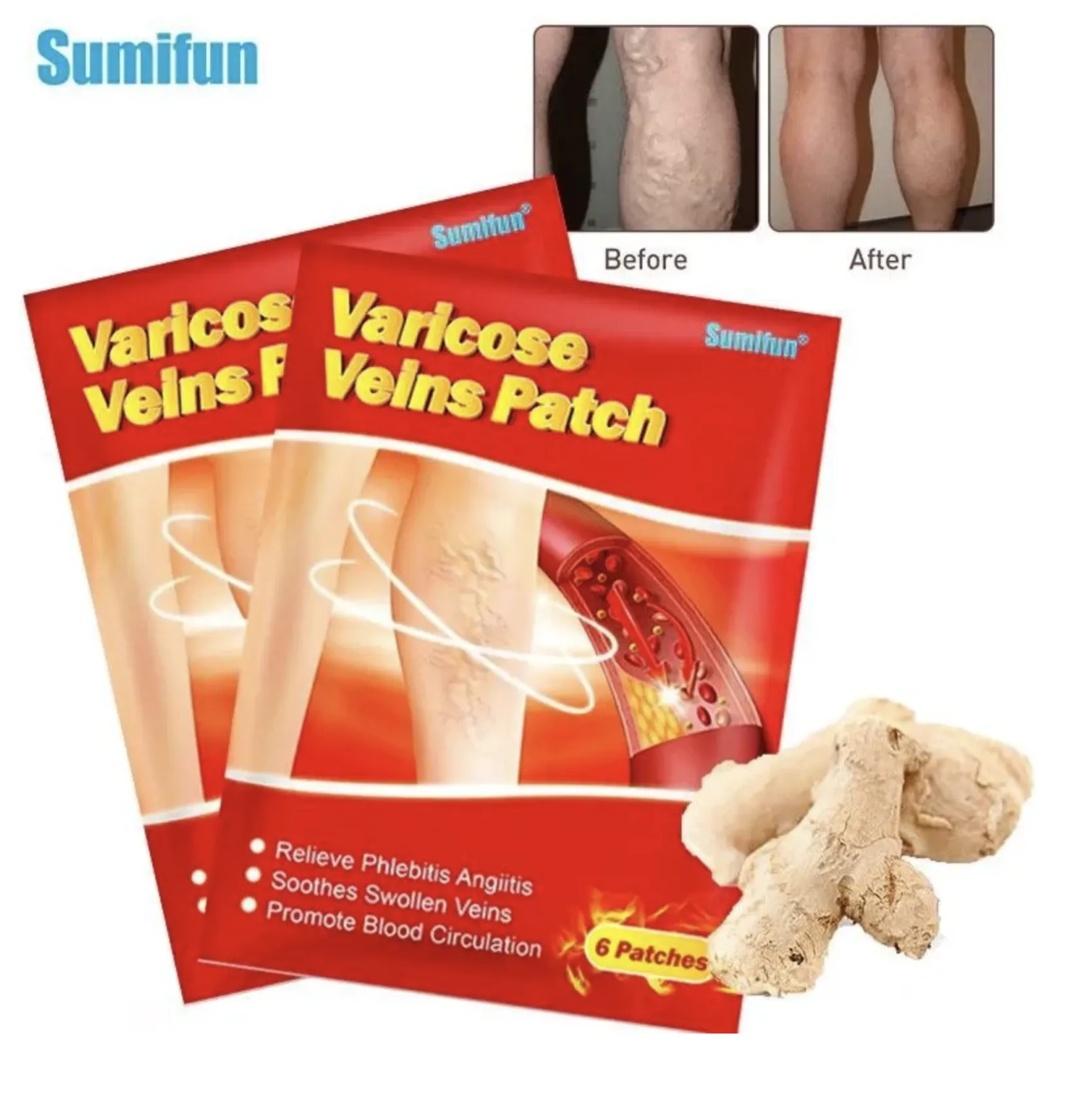 Пластыри от варикозного расширения вен Sumifun, 6 шт / Патчи для лечения варикоза и васкулита#3