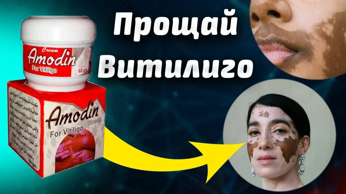 Krem Amodin vitiligo davolash uchun Harraz#2