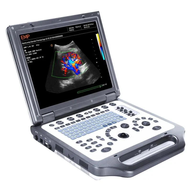 Переносной Ультразвуковой сканер Emperor Medical EMP G30#1