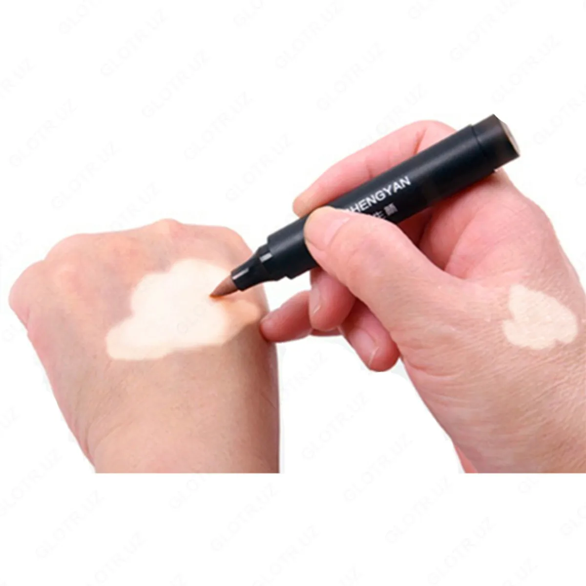 Zanderm spot vitiligo uchun aplikatori#1