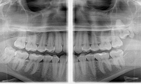 Цифровая панорамная/томографическая стоматологическая система FONA STELLARIS 3D с Цефлостата#5