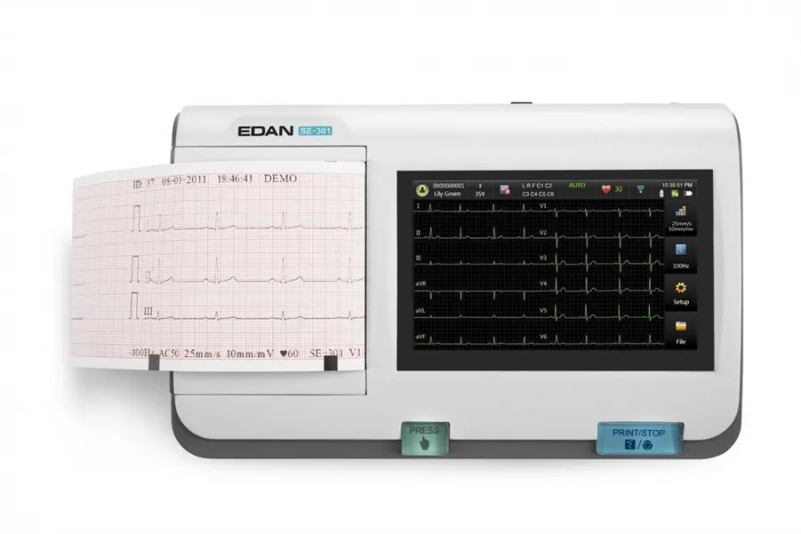 1/3-канальный портативный электрокардиограф HeartScreen 60-IKO (ЭКГ аппарат)#3