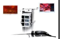 Ackermann Fusion Ginekologik va urologik jarrohlik uchun endoskopik tokchalar#1