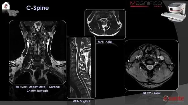 МРТ-система нового поколения с открытым магнитом и напряжением поля в 0.4 Тесла Magnifico#7