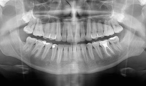 Цифровая панорамная/томографическая стоматологическая система FONA ART PLUS Цефлостата#3