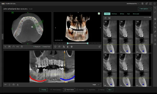 Цифровая панорамная/томографическая стоматологическая система FONA STELLARIS 3D с Цефлостата#3