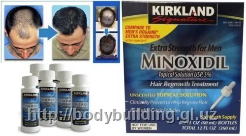 Kirkland Minoxidil#2
