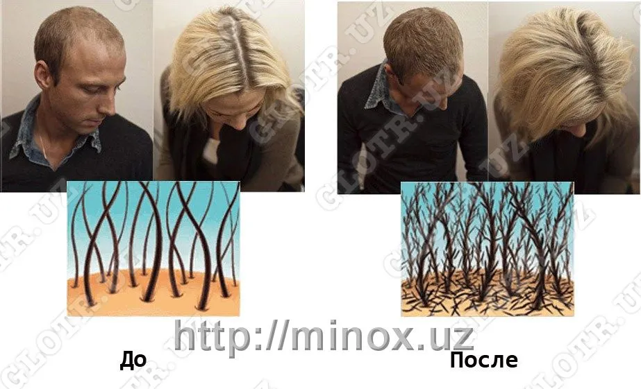 Sochlar qalinligini oshirish vositasi MinoX Hair Magic#2