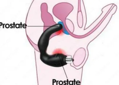 Prostata urologik massaji