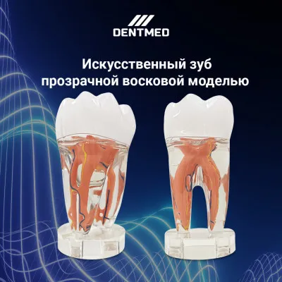 Муляж Искусственный зуб прозрачной восковой моделью Artificial tooth with transparent wax model