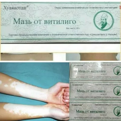 Huayaaotan malhami vitiligo davolash uchun