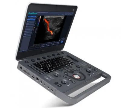 Ультразвуковой сканер SonoScape X3